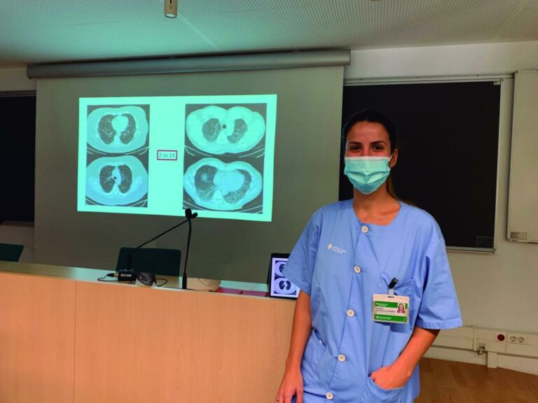 El 84% dels pacients amb COVID-19 que han estat ingressats a l’UCI presenten problemes respiratoris al cap de tres mesos de l’alta