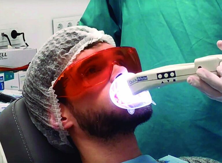 El model professional Àlex Martínez s’apunta a l’estètica dental d’Ilerdent
