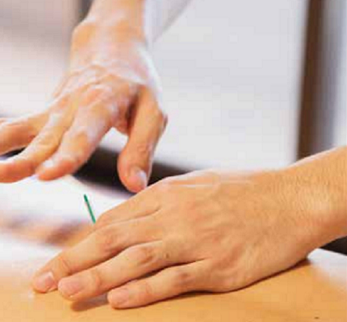 Els errors més freqüents en acudir al fisioterapeuta